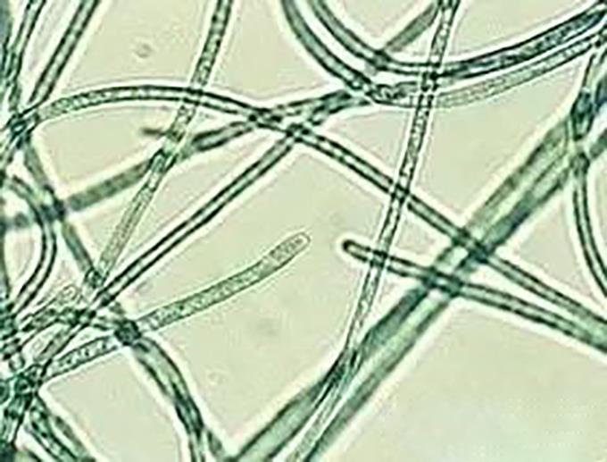 1、颤藻 没有胶质鞘或有极薄胶质鞘；以段殖体进行繁殖。