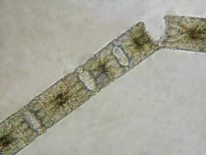 2、盒形藻 面粉袋状，两端有突起