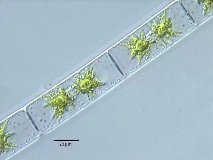 5、双星藻 不分支丝状体，细胞长为宽的2~5倍。与水绵属很像，但每个细胞具2个上下排列的星芒状色素体。